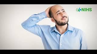 Is Hair Transplant the ONLY Solution for Hair Loss?