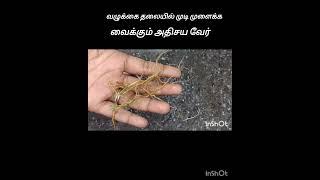 வழுக்கை தலையில் முடி முளைக்கும் shorts#hairgrowth#shortsfeed#trending#tamil#tips