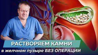 Как удалить камни в желчном пузыре? Профилактика образования камней в желчном пузыре