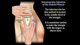 Deltoid Intramuscular injection - Everything You Need To Know - Dr. Nabil Ebraheim