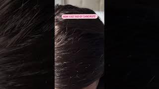 How I get rid of dandruff using a scalp massage brush