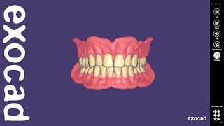 exocad Video Tutorial: Full Denture Design