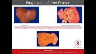 American Liver Foundation: Liver Wellness Program