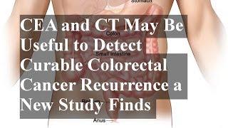 CEA and CT May Be Useful to Detect Curable Colorectal Cancer Recurrence a New Study Finds