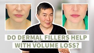 Do Dermal Fillers Actually Work for Volume Loss?