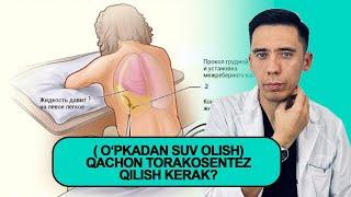 ( oʻpkadan suv olish) Qachon torakosentez qilish kerak? 