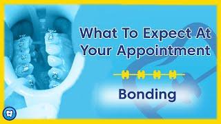 What To Expect At Your Appointment | Bonding