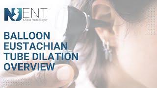 Balloon Eustachian Tube Dilation Overview | We Nose Noses