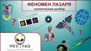 Клинический разбор - Синдром Лазаря.
