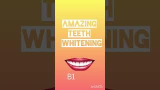 Teeth whitening LIVE DEMO; Dr. Srishti Bhatia