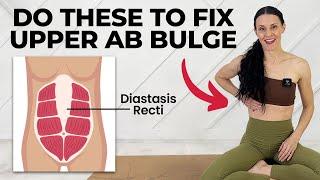 10-Min Daily Exercises To Flatten An Upper Diastasis Rect Bulge (Diastasis Recti Exercises)