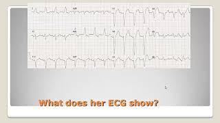 crt what does a cardiologist need to know by (Dr. Mervat Aboulmaaty)