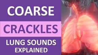 Coarse Crackles Lung Sounds Audio, Causes, Auscultation, Nursing NCLEX Review