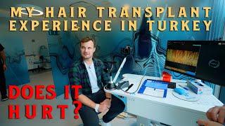 Turkey Hair Transplant Journey: From Fear to Confidence in 3 Days