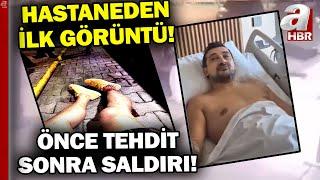 Önce Tehdit Sonra Saldırı! Serhat Akın'a Saldırıyı Kim Neden Düzenledi? | A Haber