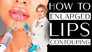 How to enlarge lips VIDEO LESSON, Princess Volume (hyaluronic acid), lip contouring