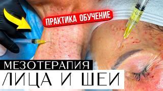 Мезотерапия Лица и шеи - ПРАКТИКА ОБУЧЕНИЕ. Видео урок.