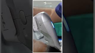 Revealing the Amazing Results of Hifu Treatment | Awish Clinic | #viral #shortsfeed #ytshorts