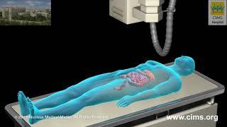 Barium Enema – CIMS Hospital