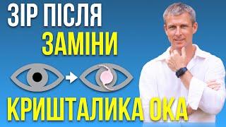 Лікування катаракти - який зір буде після операції