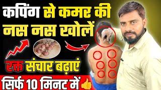 कपिंग थेरेपी के फायदे|Dry Cupping Therapy For Back Pain|Dry Cupping Therapy At Home