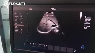 DW-T5 color doppler ultrasound scanner machine price with low cost