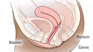 Parts of uterus 3D view (part 1) female reproductive organ