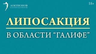 Как избавиться от жировых ловушек в области “галифе”? / #shorts /18+