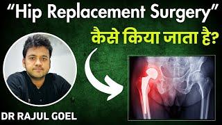 Hip Replacement Surgery | Dr Rajul Goel | Hip Replacement in Kurukshetra | THR Kurukshetra