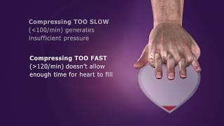 Conventional CPR Overview
