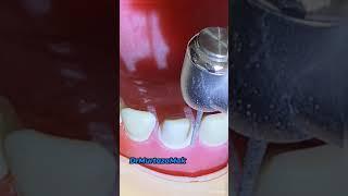 Samurai Dental Skills- Crown prep skills