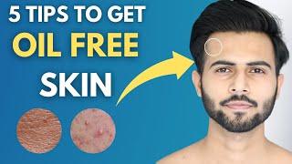 5 Tips to get Oil + Acne Free Skin  | Oily Skin Care Tips | Winter Skin Care |