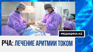 Чем сердце успокоится: как уберечься от тахикардии, что такое РЧА, и лечение аритмии током