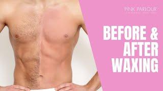 BEFORE AND AFTER WAXING AT PINK PARLOUR