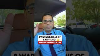 Doctor Sethi Explains 8 Warning Signs of Fatty Liver You Do Not Want To Miss 