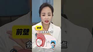 #关爱女性健康 #医学科普 #妇科知识