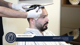 Hair Transplant Turkey | Medart Hair Istanbul