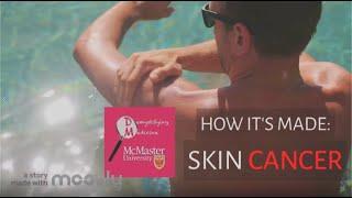 How it’s Made: Skin Cancer