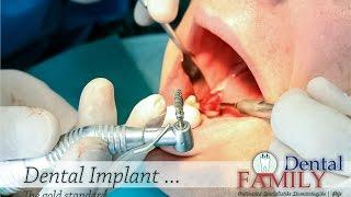 Dr Granit Hyseni - Dental Implant Surgery  NeoBiotech [HD]