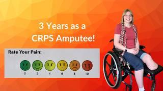 Celebrating 3 Years as a CRPS Amputee! Life as an Amputee