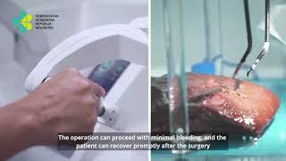 First Robotic Telesurgery in Indonesia using "Sina Flex Robotic Telesurgery system" over 5G internet