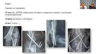 Чрезмыщелковые переломы у детей как мультидисциплинарная проблема