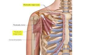 Pectoralis Minor   Drawn Figure Attachments