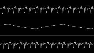 Jeff - “Euro-Dance” (C64) [Oscilloscope View]