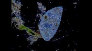 A Stentor Wading Through Life