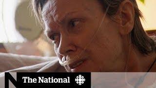 Assisted dying: What happens when doctors disagree on what the law says?