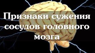 Признаки сужения сосудов головного мозга