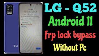 LG Q52 frp bypass / All Lg Android 11 Google account lock bypass, without pc