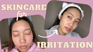 SKINCARE ROUTINE for IRRITATED SKIN