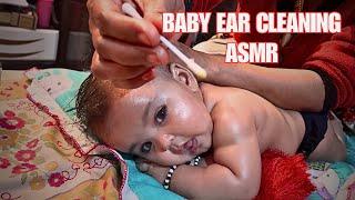 Dirtiest Ear Wax found During Ear Cleaning of baby | Best Experience Baby Girl l Ear Wax Removal